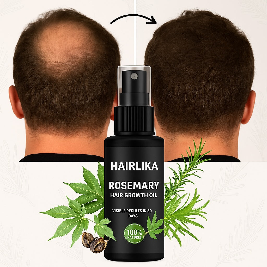 Hairlika – Hair Growth Oil
